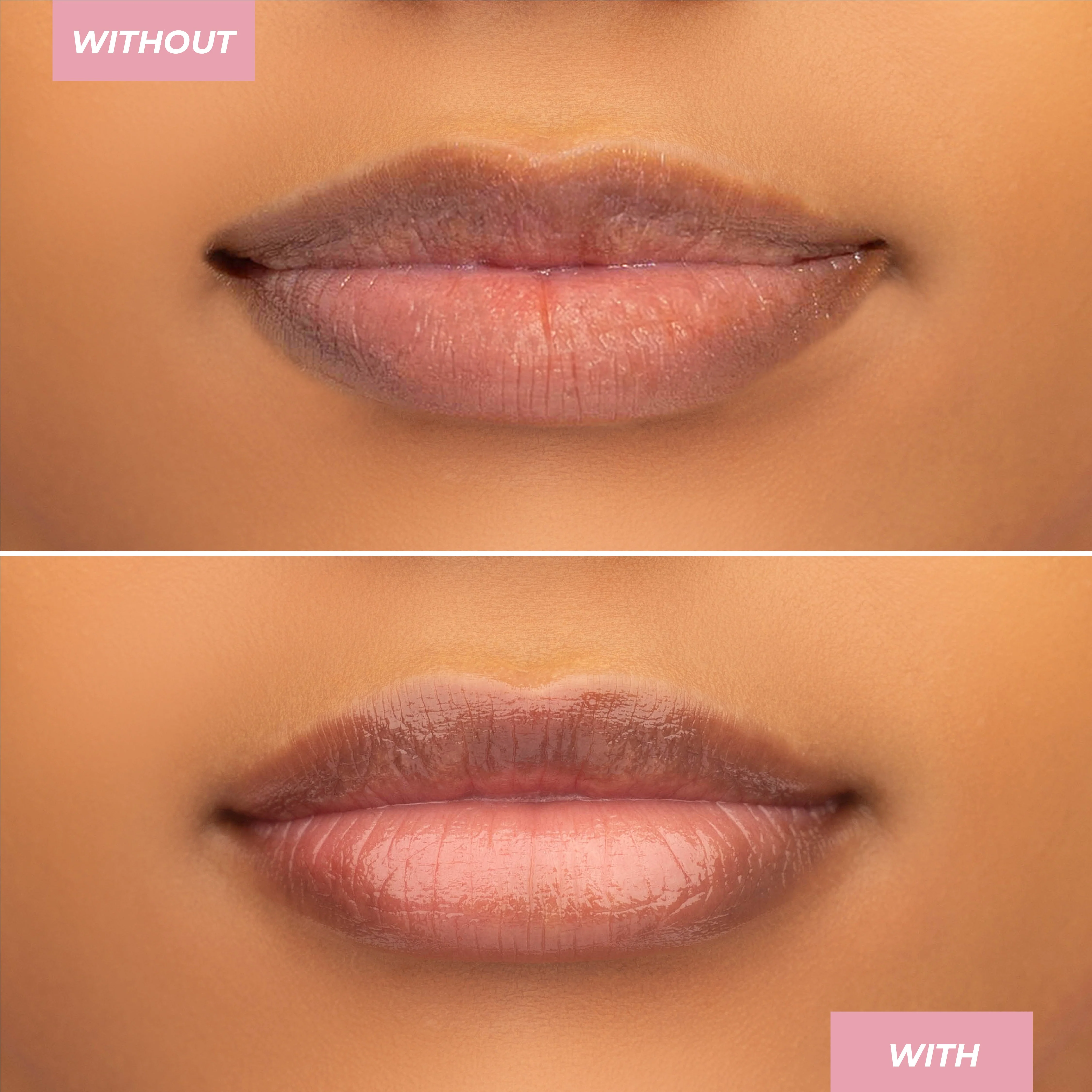 Hyaluronic Lip Balm - Image 25