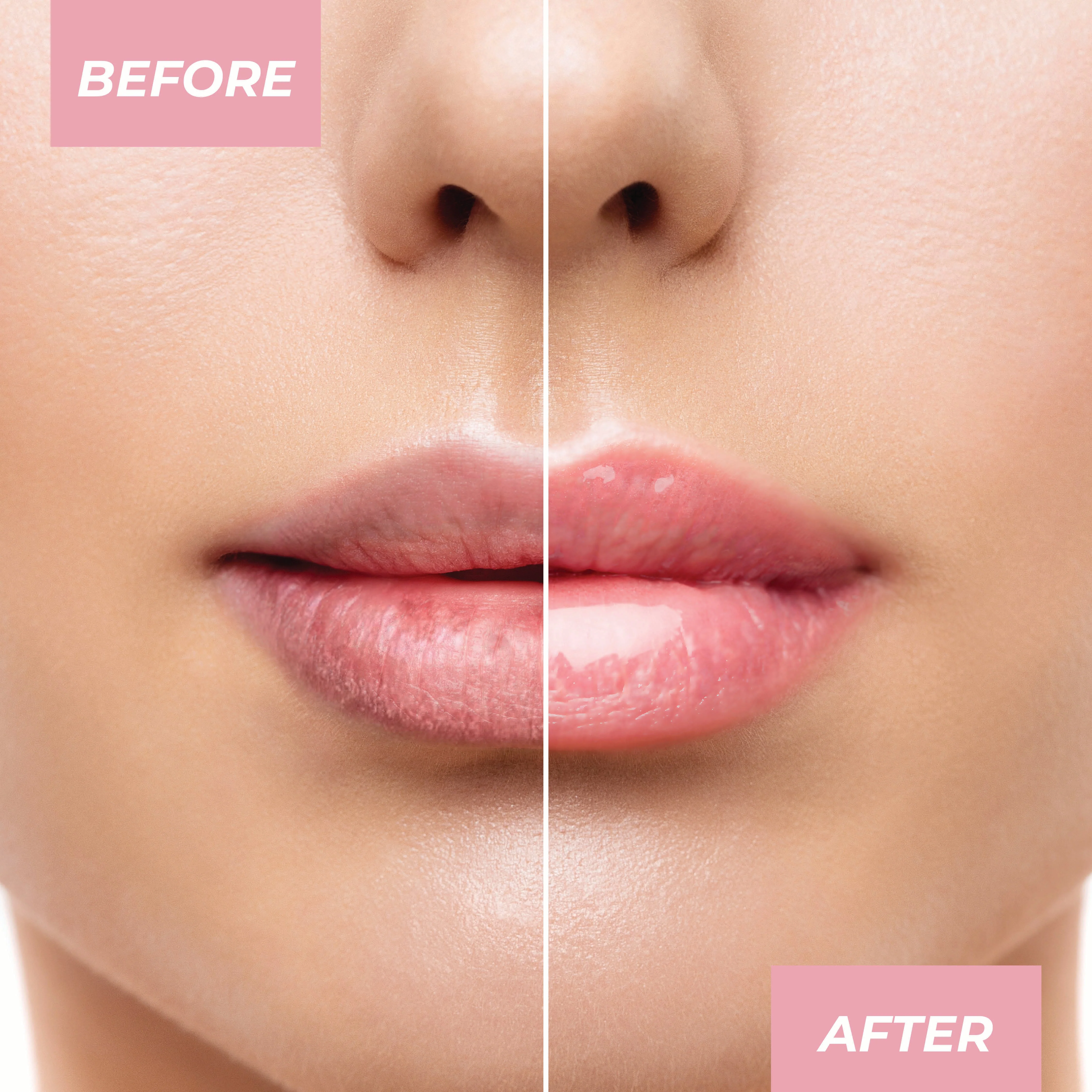 Overnight Lip Mask - Image 28